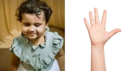Children Health : കുപ്പിയുടെ അടപ്പ് തൊണ്ടയില് കുടുങ്ങി മരണം; ഒരു മാസത്തിനകം സമാനമായ എത്ര സംഭവം!