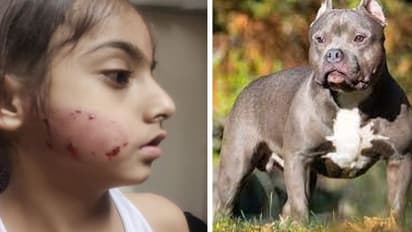 सावधान! पिटबुल डॉग ने देखिए 9 साल के मासूम का क्या हाल कर दिया, थाने पहुंचा मामला