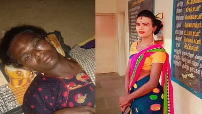 திருநங்கை மீது கொடூர தாக்குதல்… குற்றவாளிகள் மீது பல்வேறு பிரிவுகளில் வழக்குப்பதிவு!!