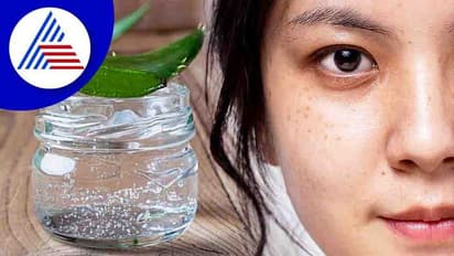 ಸುಡು ಬಿಸಿಲಿಗೆ ಸೌಂದರ್ಯ ಹಾಳಾಗುತ್ತೆ ಅನ್ನೋ ಭಯ ಬೇಡ, ಅಲೋವೆರಾ ಹೀಗೆ ಬಳಸಿ ನೋಡಿ