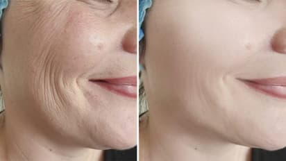 త్వరగా వృద్ధాప్యం రాకూడదంటే జీవనశైలిలో ఈ మార్పులు తప్పనిసరి..!  