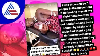 KGF ಹಾಡಿಗೆ ರೀಲ್ ಮಾಡಿದ್ದ ಆಫ್ರಿಕಾದ ಇನ್ಸ್ಟಾ ಸ್ಟಾರ್ ಕಿಲಿ ಪೌಲ್ ಮೇಲೆ ಹಲ್ಲೆ; ನನಗಾಗಿ ಪ್ರಾರ್ಥಿಸಿ ಎಂದು ಮನವಿ