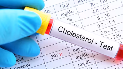 മരുന്നില്ലാതെ ഉയർന്ന കൊളസ്ട്രോൾ എങ്ങനെ കുറയ്ക്കാം?