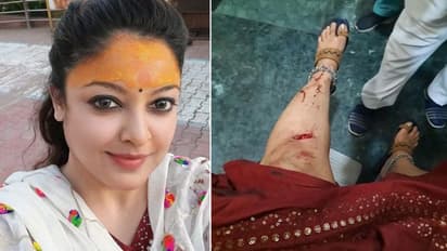 उज्जैन के महाकाल के दर्शन करने से पहले तनुश्री दत्ता के साथ हादसा, एक्ट्रेस ने शेयर की खून से सने पैर की फोटो