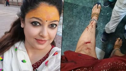 Tanushree Dutta ‘prayed for no broken bones’ after ‘freak accident’; sustains stitches