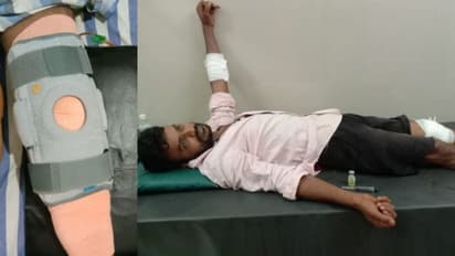 ಕಾಲಿನ ಗಾಯದಲ್ಲಿ 14 ಕಲ್ಲುಗಳು ಪತ್ತೆ, ಕ್ಲೀನ್ ಮಾಡದೇ ಹೊಲಿಗೆ ಹಾಕಿದ್ದ ಆಸ್ಪತ್ರೆ ಸಿಬ್ಬಂದಿ!