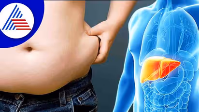World liver day 2022: இன்று உலக கல்லீரல் அழற்சி தினம்...கல்லீரலை பாதுகாக்க செய்ய வேண்டியவை..செய்ய கூடாதவை..