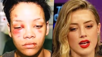 Rihanna’s abuse look was compared to Amber Heard’s done by Johnny Depp; here's what netizens say