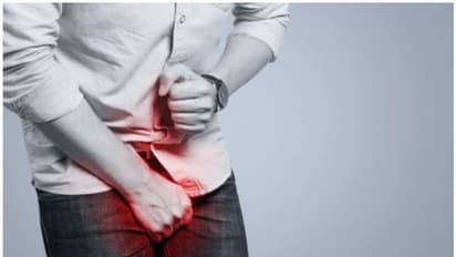 സെക്‌സിനിടെ ലിംഗം വീർത്തു, പർപ്പിൾ നിറമായി; അപൂർവ രോ​ഗാവസ്ഥ എന്ന് ഡോക്ടർമാർ 