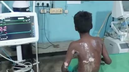 11 വയസ്സുകാരന് നേരെ ജാതി അതിക്ഷേപം, തീപ്പൊളളലേൽപ്പിച്ചു, മൂന്ന് പേർക്കെതിരെ കേസ്