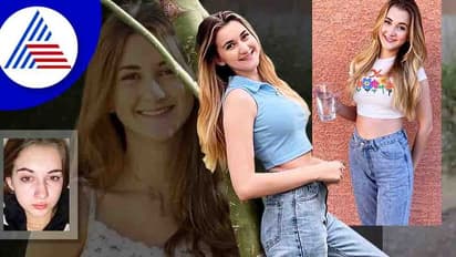 ಈಕೆಗೆ ನೀರೆಂದರೇ ಅಲರ್ಜಿ, ಕುಡಿದರೆ ವಾಂತಿಯಾಗುತ್ತೆ, ಕಣ್ಣೀರು ಹಾಕಿದರೆ ಆಸಿಡ್ ಸುರಿದಂತಾಗುತ್ತೆ !