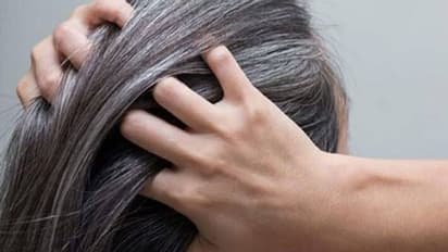 वक्त से पहले हो रहे हैं सफेद बाल, तो नाभि पर लगाए ये चीज, ब्लैक हेयर के साथ मिलेगा ये फायदा