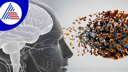 Health Tips: ಕೊರೋನಾ ನಂತ್ರ ನಿಮ್ಮ ಮೆಮೊರಿ ದುರ್ಬಲವಾಗ್ತಿದೆಯಾ ? 
