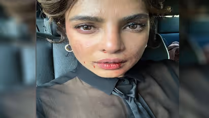 होठों पर खून-आंखों में आंसू, प्रियंका चोपड़ा के साथ ये क्या हो गया?