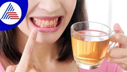 ಹಲ್ಲುಗಳ ಬಣ್ಣಗೆಡಿಸೋ ಆಹಾರಗಳಿವು, ತಿಂದ್ರೆ ಕಲೆ ಹಾಗೇ ಉಳಿದುಬಿಡುತ್ತೆ !