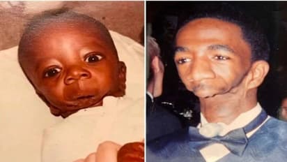 'मैं पैदा हुआ तो मां मुझे देखकर डर गई, अनाथ छोड़कर चली गई, आज भी डरते हैं और दूर भागते हैं लोग'