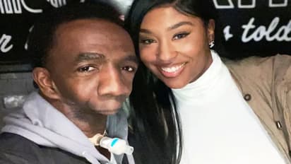 बिना जबड़े के पैदा हुआ ये शख्स, 41 साल में अब तक नहीं जान पाया कैसा होता है खाने का स्वाद