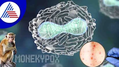 ಕೋವಿಡ್ ಭೀತಿ ನಡುವೆ ಮಂಕಿಪಾಕ್ಸ್ ಪ್ರಕರಣ ಏರಿಕೆ, ದೆಹಲಿಯಲ್ಲಿ ಮತ್ತೊಂದು ಕೇಸ್ ಪತ್ತೆ!