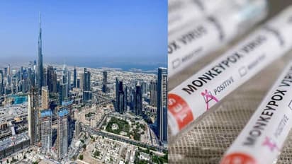 Monkeypox Case: UAE-ல் பதிவானது முதல் குரங்கு அம்மை... அந்நாட்டு சுகாதாரத்துறை அதிர்ச்சி தகவல்!!