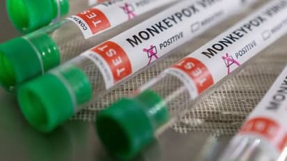 മങ്കിപോക്സ് സ്ഥിരീകരണം: സമ്പര്‍ക്കപ്പട്ടികയിലുള്ള 20 പേര് കരുതല്‍ നിരീക്ഷണത്തില്‍, രോഗലക്ഷണമില്ലെന്ന് മന്ത്രി