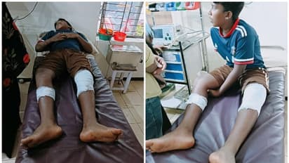 തിരുവമ്പാടിയിൽ കാട്ടുപന്നിയുടെ ആക്രമണം; പന്ത്രണ്ടുകാരനെ കുത്തിവീഴ്ത്തി, പന്നിയെ വെടിവെച്ച് കൊന്നു