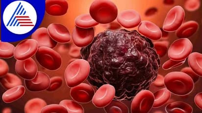 ಕ್ಯಾನ್ಸರ್ಗೆ ಚಿಕಿತ್ಸೆ ವ್ಯವಸ್ಥೆ ಇಲ್ಲದಿದ್ದರೂ ಬೇರೆ ಕಡೆ ಟ್ರೀಟ್ಮೆಂಟ್ಗೆ ಪತ್ರ ನೀಡಲು ಜಿಲ್ಲಾಸ್ಪತ್ರೆ ಹಿಂದೇಟು..!