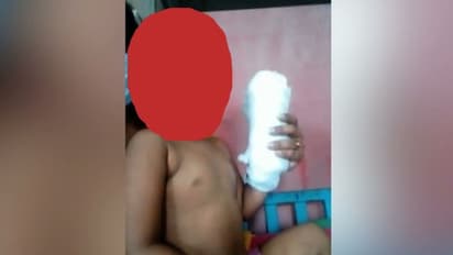 പിഞ്ചുകുഞ്ഞിന്റെ ശസ്ത്രക്രിയ വൈകിയ സംഭവം: അന്വേഷണ റിപ്പോര്ട്ട് തേടി മനുഷ്യാവകാശ കമ്മീഷൻ