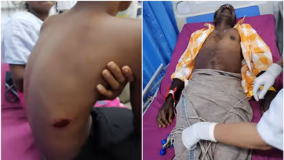 ദുരിതം വിതച്ച് ഇടിമിന്നൽ; മൂന്ന് പേർക്ക് പരിക്കേറ്റു,രണ്ട് വീടുകൾക്ക് ഭാഗിക നാശമുണ്ടായി