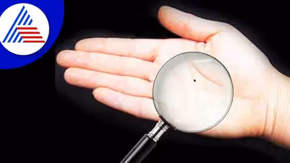 இந்த அபூர்வ மச்சம் இருந்தால், அவர் கோடீஸ்வரர்! நவகிரக மச்சங்களும் அவற்றின் பலன்களும்.. 