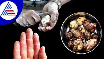 Kitchen Hacks: ಕೆಸು ಸಿಪ್ಪೆ ತೆಗೆಯುವಾಗ ಕೈ ತುರಿಸುತ್ತಾ? ಇಲ್ಲಿವೆ ಟಿಪ್ಸ್