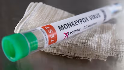 4th Monkeypox Case in India: ವಿದೇಶಕ್ಕೇ ಹೋಗದ ವ್ಯಕ್ತಿಗೆ ಬಂತು ಮಂಕಿಪಾಕ್ಸ್..!