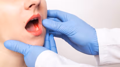 Oral cancer : വായിലെ കാൻസർ പിടിപെടുന്നതിന് പിന്നിലെ ഒരു പ്രധാനപ്പെട്ട കാരണം; വിദ​ഗ്ധർ പറയുന്നു 