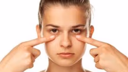 കണ്ണിന് ചുറ്റുമുള്ള 'ഡാർക്ക് സർക്കിൾസ്' മാറ്റാൻ ഈ ചേരുവകള്‍ ഉപയോ​ഗിക്കൂ...