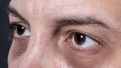 வெறும் '1' ஸ்பூன் பால் போதும்.. முக அழகை கெடுக்கும் 'கருவளையம்' நீங்கும்!!