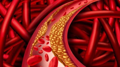 Cholesterol  : കൊളസ്ട്രോൾ കുറയ്ക്കാൻ സഹായിക്കുന്ന നാല് പച്ചക്കറികൾ