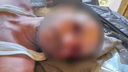 बदायूं जिला अस्पताल में कैदी की लाश से गायब हुई आंखे, सीएमएस ने झाड़ा पल्ला