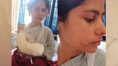 নার্সের চাকরি পেয়ে ছেড়ে চলে যাবে স্ত্রী ? আশঙ্কায় ঘুমন্ত বউয়ের কবজি থেকে হাত কেটে নিলেন স্বামী