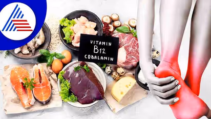 Health Tips : ಪಾದಕ್ಕೆ ಬೆಂಕಿ ಹಚ್ಚಿದಾಂಗಾಗ್ತಿದ್ಯಾ? ಇಲ್ಲಿದೆ ಪರಿಹಾರ