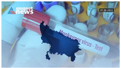 உலகில் 1000க்கும் மேற்பட்டோருக்கு குரங்கு அம்மை நோய் பாதிப்பு! - WHO எச்சரிக்கை