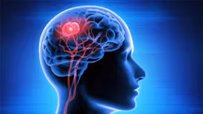 World Brain Day 2022 :തലച്ചോറിന്റെ ആരോഗ്യത്തിനായി കഴിക്കേണ്ട 8 ഭക്ഷണങ്ങൾ