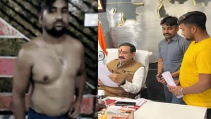 MP में पुलिसवालों की थर्ड डिग्री: युवक को इतना पीटा की गर्दन की हड्डी टूट गई, कान का पर्दा फटा-उधड़ गई चमड़ी