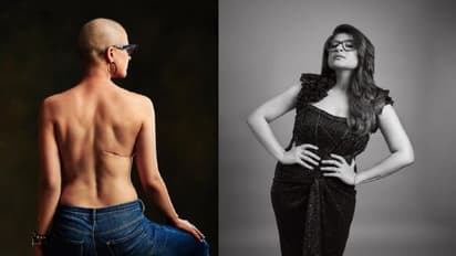 ವಿಶ್ವ ಕ್ಯಾನ್ಸರ್ ದಿನ; ಪತ್ನಿ ತಹಿರಾಳ ನಗ್ನ ಬೆನ್ನಿನ ಫೋಟೋ ಹಾಕಿ ವಿಶೇಷ ಸಂದೇಶ ಬರೆದ ಆಯುಶ್ಮಾನ್ ಖುರಾನಾ