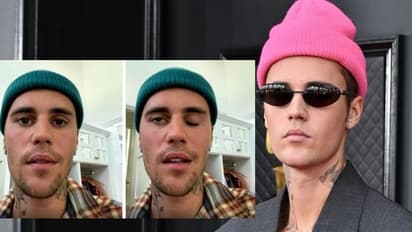 'തനിക്ക് റാംസെ ഹണ്ട് സിൻഡ്രോം': മുഖത്ത് പക്ഷാഘാതം വന്നു വെളിപ്പെടുത്തി ജസ്റ്റിൻ ബീബർ