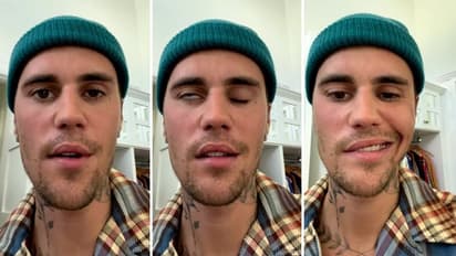 एक वायरस ने बिगाड़ दिया 28 साल के जस्टिन बीबर का चेहरा, बोले- न मैं आंख झपका सकता हूं और न ही मुस्करा सकता हूं