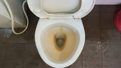 ஒரே '1' பொருள் இருந்தா போதும்.. டாய்லெட்டில் படிந்த மஞ்சள் கறையை நொடியில் போக்கிடலாம்!!