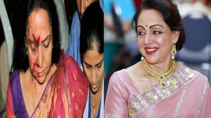 चोट के निशान ने  बिगाड़ा इन 7 एक्ट्रेसेस का चेहरा, एक का तो करियर ही खत्म हो गया