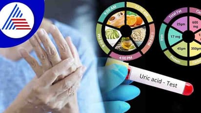 Uric Acid: உடலில் யூரிக் அமிலத்தை கட்டுப்படுத்த...சாப்பிட வேண்டிய பழங்கள் இவைகள்தான்..மிஸ் பண்ண வேண்டாம்..!