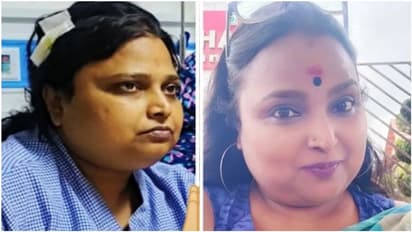 ಅಪಘಾತದ ಬಳಿಕ ಹೇಗಿದ್ದಾರೆ ಸುನೇತ್ರಾ ಪಂಡಿತ್; ಫೋಟೋ ಶೇರ್ ಮಾಡಿದ ನಟಿ