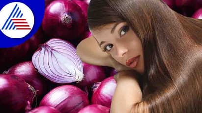 Hair Care: ಕಣ್ಣೀರು ಬರೆಸುವ ಈರುಳ್ಳಿ ಕೂದಲಿಗೆ ರಾಮಬಾಣ!