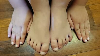  6 साल का बच्चा हुआ जब कोरोना पॉजिटिव, उसके हाथ-पैर के नाखून देखकर पैरेंट्स के उड़ गए होश, जानिए क्या थी वजह?